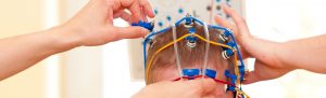 Wie wird eine Epilepsie erkannt?