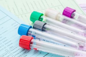 Welche Untersuchungen sind bei Polyneuropathien notwendig?